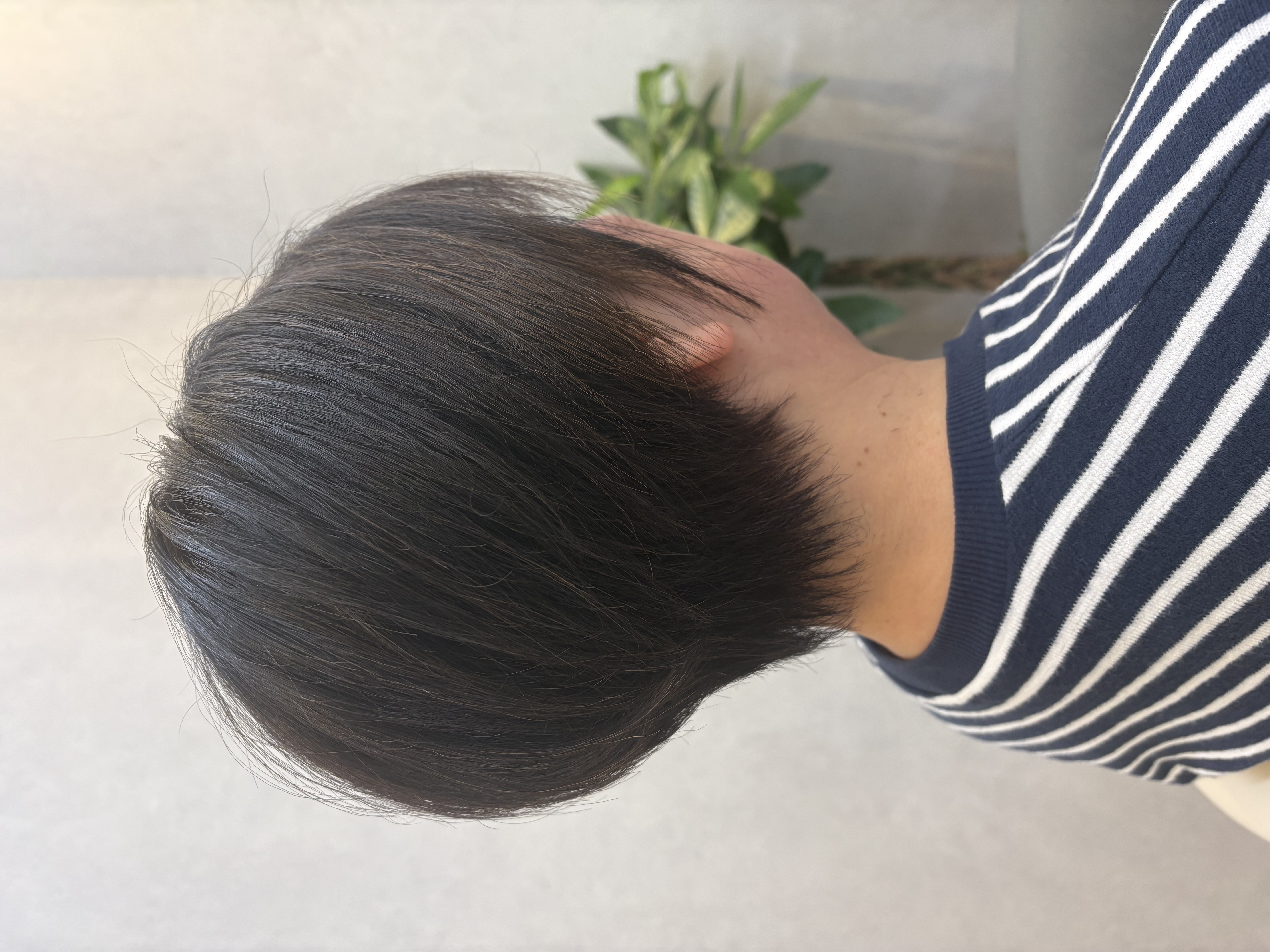 スカルプケアの重要性とは？